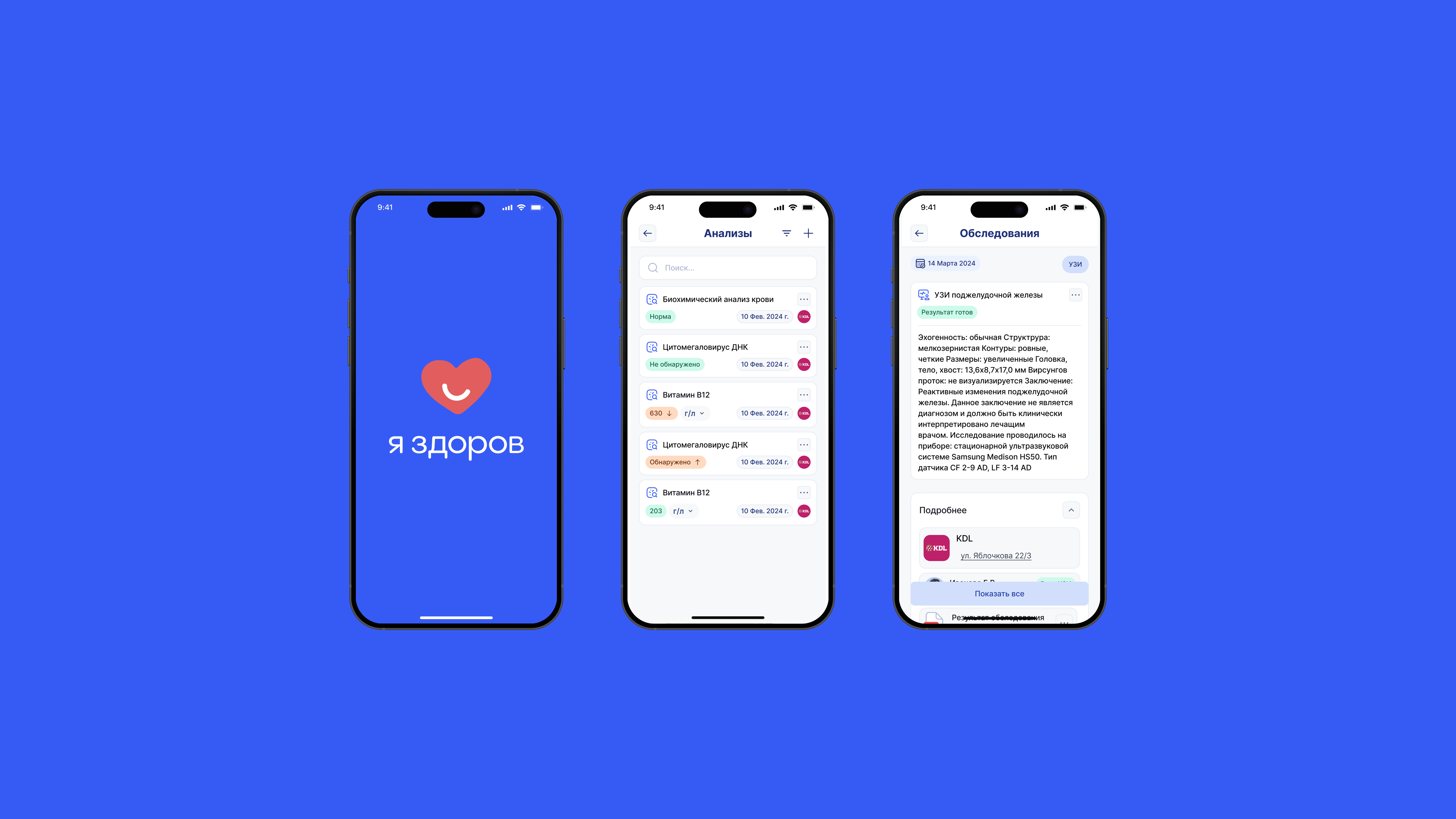 Вторая картинка.png